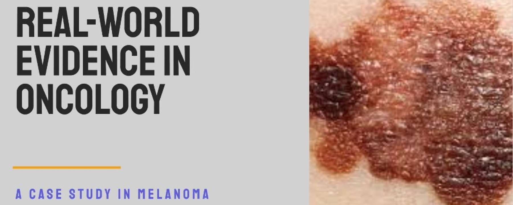 Proyecto de Evidencia del Mundo Real en Oncología